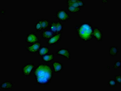 ER Alpha / Estrogen Receptor Antibody - Immunofluorescent analysis of MCF-7 cells using ESR1 Antibody at dilution of 1:100 and Alexa Fluor 488-congugated AffiniPure Goat Anti-Rabbit IgG(H+L)