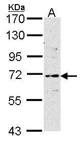 ER Alpha / Estrogen Receptor Antibody - 30ug of MCF7 whole cell lysate, 7.5% SDSPAGE