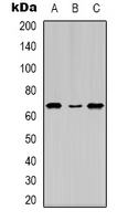 ER Alpha / Estrogen Receptor Antibody - Western blot analysis of Estrogen Receptor alpha (pS104) expression in HEK293T (A); HeLa (B); MCF7 (C) whole cell lysates.
