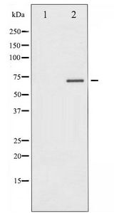 ER Alpha / Estrogen Receptor Antibody - Western blot of Estrogen Receptor- alpha phosphorylation expression in 293 whole cell lysates,The lane on the left is treated with the antigen-specific peptide.