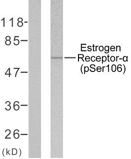 ER Alpha / Estrogen Receptor Antibody - Western blot analysis of lysates from MCF7 cells, using Estrogen Receptor-alpha (Phospho-Ser106) Antibody. The lane on the left is blocked with the phospho peptide.
