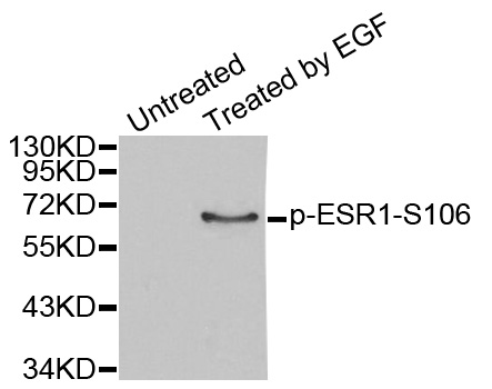 ER Alpha / Estrogen Receptor Antibody - Western blot analysis of extracts from MCF7 cells.