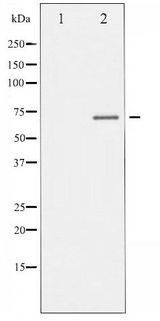 ER Alpha / Estrogen Receptor Antibody - Western blot of Estrogen Receptor- alpha phosphorylation expression in MCF7 whole cell lysates,The lane on the left is treated with the antigen-specific peptide.