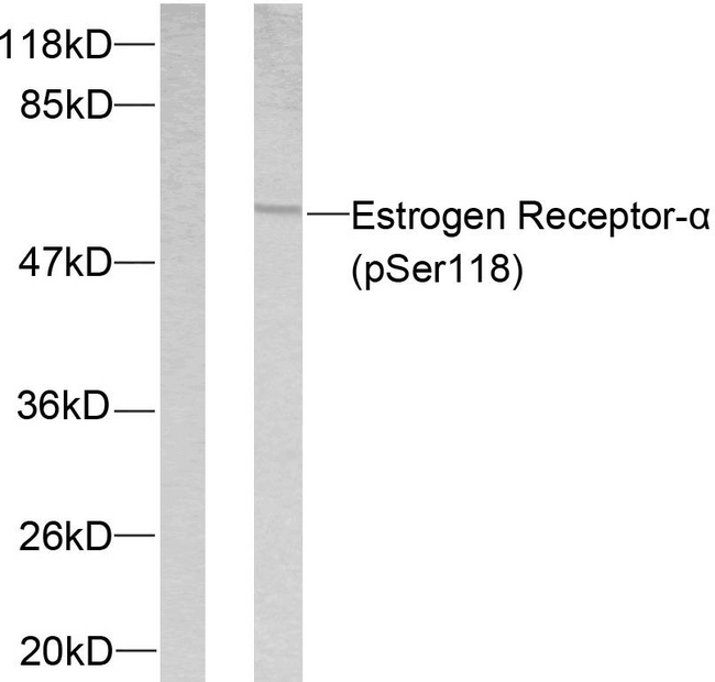 ER Alpha / Estrogen Receptor Antibody - Western blot analysis of lysates from MCF7 cells treated with Estradiol, using Estrogen Receptor-alpha (Phospho-Ser118) Antibody. The lane on the left is blocked with the phospho peptide.