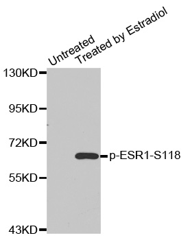 ER Alpha / Estrogen Receptor Antibody - Western blot analysis of extracts from MDA cells.