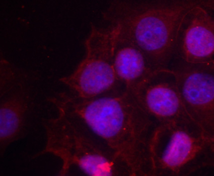 ER Alpha / Estrogen Receptor Antibody - Immunofluorescence staining of methanol-fixed MCF cells.