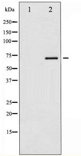 ER Alpha / Estrogen Receptor Antibody - Western blot of Estrogen Receptor- alpha phosphorylation expression in Estradiol treated MCF7 whole cell lysates,The lane on the left is treated with the antigen-specific peptide.