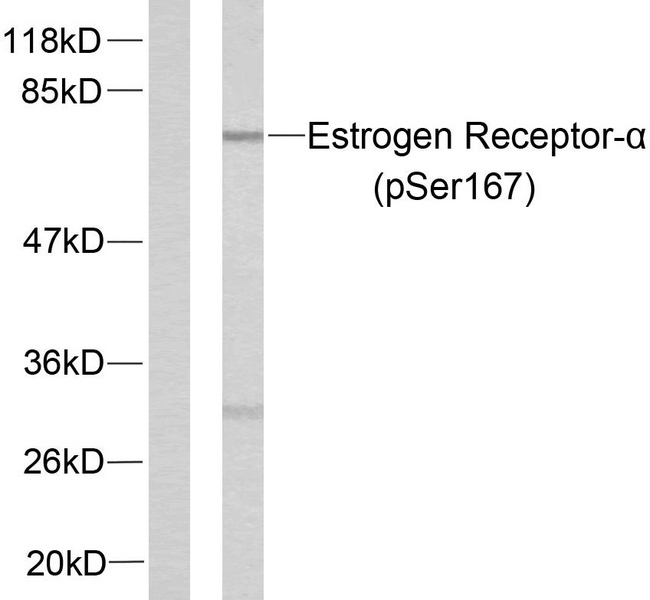 ER Alpha / Estrogen Receptor Antibody - Western blot analysis of lysates from MCF7 cells treated with EGF, using Estrogen Receptor-alpha (Phospho-Ser167) Antibody. The lane on the left is blocked with the phospho peptide.