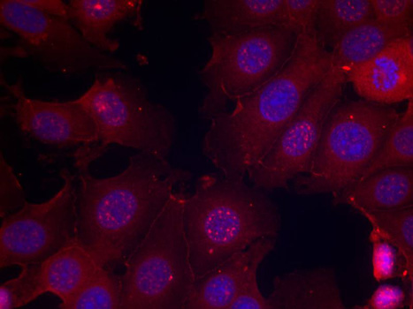 ER Alpha / Estrogen Receptor Antibody - Immunofluorescence staining of methanol-fixed MCF cells.