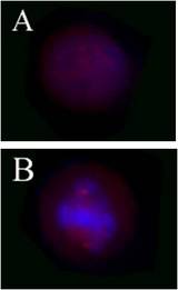 ER Alpha / Estrogen Receptor Antibody - Untreated Hela cells (Panel A), or overnight nocodazole treated Hela cells (Panel B) stained with purified rabbit polyclonal antibody Poly6365 against phospho-ERa (Ser 167), followed by Cy3-conjugated Donkey anti-rabbit IgG and DAPI.
