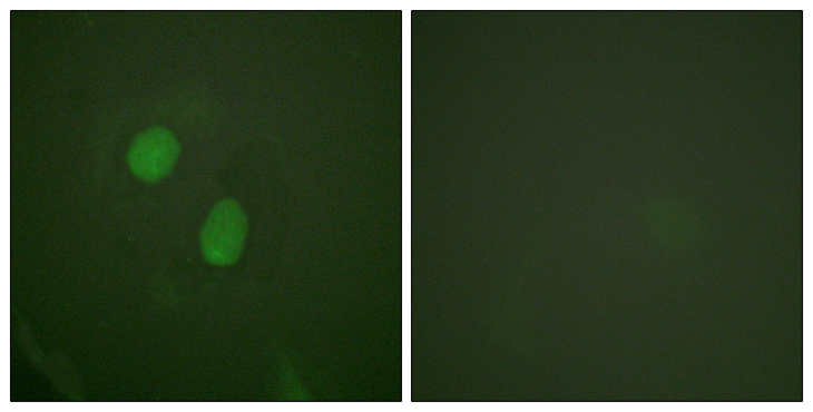 ER Alpha / Estrogen Receptor Antibody - Immunofluorescence analysis of HeLa cells treated with EGF 200nM 5', using Estrogen Receptor-alpha (Phospho-Ser305) Antibody. The picture on the right is blocked with the phospho peptide.