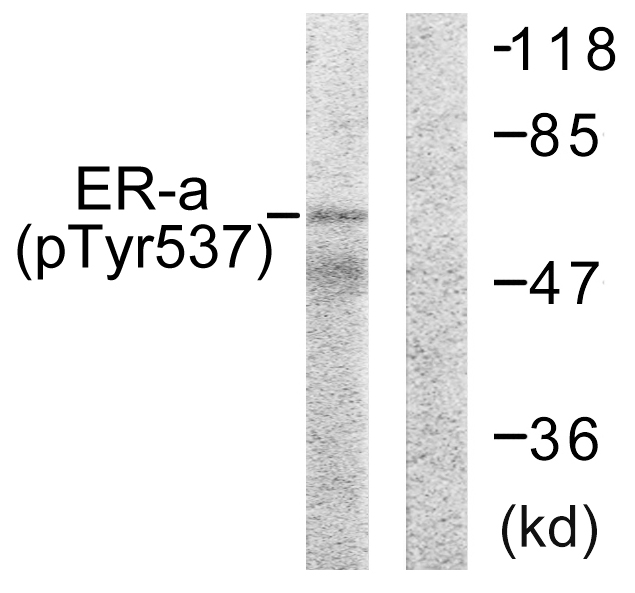 ER Alpha / Estrogen Receptor Antibody - Western blot analysis of lysates from 293 cells, using Estrogen Receptor-alpha (Phospho-Tyr537) Antibody. The lane on the right is blocked with the phospho peptide.