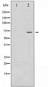 ER Alpha / Estrogen Receptor Antibody - Western blot of Estrogen Receptor- alpha phosphorylation expression in 293 whole cell lysates,The lane on the left is treated with the antigen-specific peptide.