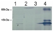 ER Alpha / Estrogen Receptor Antibody - Immunodetection Analysis: Lane 1.cell lysate MCF-7; Lane 2. cell lysate A431; Lane 3. cell lysate 293T; Lane 4. positive control, ER protein. The membrane blot was probed with anti-ER primary antibody (0.2?g/ml). The binding bands were visualized using AP-conjugated goat anti-rabbit secondary antibody and then adding NBT/BCIP substrate. Arrows indicate ER in tested cell lysates (about 40 kDa).