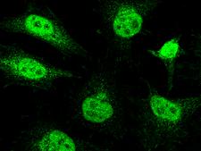 ER Alpha / Estrogen Receptor Antibody - Immunofluorescence staining of ER alpha/ESR1 in Hela cells. Cells were fixed with 4% PFA, permeabilzed with 0.3% Triton X-100 in PBS, blocked with 10% serum, and incubated with rabbit anti-Human ER alpha/ESR1 polyclonal antibody (dilution ratio: 1:1000) at 4°C overnight. Then cells were stained with the Alexa Fluor 488-conjugated Goat Anti-rabbit IgG secondary antibody (green). Positive staining was localized to cytoplasm and nucleus.