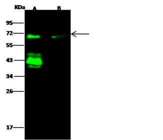 ER Alpha / Estrogen Receptor Antibody - Anti-ER alpha/ESR1 rabbit polyclonal antibody at 1:500 dilution. Lane A: Molt4 Whole Cell Lysate. Lane B: Raji Whole Cell Lysate. Lysates/proteins at 30 ug per lane. Secondary: Goat Anti-Rabbit IgG H&L (Dylight 800) at 1/10000 dilution. Developed using the Odyssey technique. Performed under reducing conditions. Predicted band size: 67 kDa. Observed band size: 67 kDa. (We are unsure as to the identity of these extra bands.)