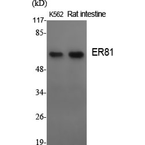 ER81 / ETV1 Antibody - Western blot of ER81 antibody