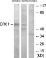 ER81 / ETV1 Antibody - Western blot analysis of lysates from HUVEC cells, treated with PMA 125ng/ml 30', using ER81 Antibody. The lane on the right is blocked with the synthesized peptide.