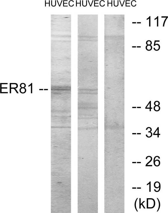 ER81 / ETV1 Antibody - Western blot analysis of lysates from HUVEC cells, treated with PMA 125ng/ml 30', using ER81 Antibody. The lane on the right is blocked with the synthesized peptide.