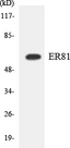 ER81 / ETV1 Antibody - Western blot analysis of the lysates from HT-29 cells using ER81 antibody.