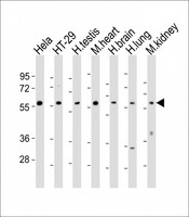 ER81 / ETV1 Antibody - All lanes: Anti-ETV1 Antibody (C-Term) at 1:2000 dilution. Lane 1: HeLa whole cell lysates. Lane 2: HT-29 whole cell lysates. Lane 3: human testis lysates. Lane 4: mouse heart lysates. Lane 5: human brain lysates. Lane 6: human lung lysates. Lane 7: mouse kidney lysates Lysates/proteins at 20 ug per lane. Secondary Goat Anti-Rabbit IgG, (H+L), Peroxidase conjugated at 1:10000 dilution. Predicted band size: 55 kDa. Blocking/Dilution buffer: 5% NFDM/TBST.