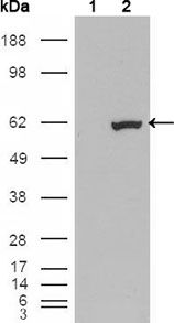 ER81 / ETV1 Antibody - ETV1 Antibody in Western Blot (WB)