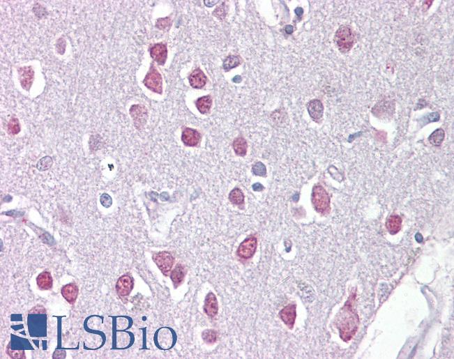 ER81 / ETV1 Antibody - Anti-ETV1 / ER81 antibody IHC of human brain, cerebellum. Immunohistochemistry of formalin-fixed, paraffin-embedded tissue after heat-induced antigen retrieval. Antibody concentration 5 ug/ml.  This image was taken for the unconjugated form of this product. Other forms have not been tested.