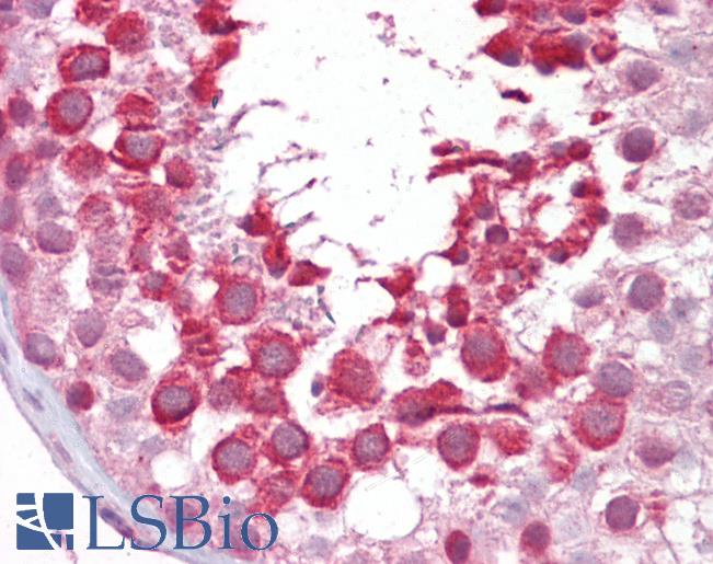ER81 / ETV1 Antibody - Human Testis: Formalin-Fixed, Paraffin-Embedded (FFPE).  This image was taken for the unconjugated form of this product. Other forms have not been tested.