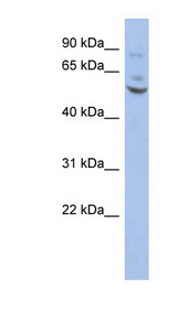 ER81 / ETV1 Antibody - ETV1 / ER81 antibody Western blot of HT1080 cell lysate. This image was taken for the unconjugated form of this product. Other forms have not been tested.