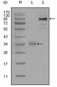 ER81 / ETV1 Antibody - Western blot using ETV1 mouse monoclonal antibody against truncated Trx-ETV1 recombinant protein (1) and full-length ETV1 (aa1-477)-hIgGFc transfected CHO-K1 cell lysate(2).