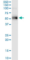 ER81 / ETV1 Antibody - ETV1 monoclonal antibody (M01), clone 2A8. Western Blot analysis of ETV1 expression in human pancreas.