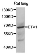 ER81 / ETV1 Antibody - Western blot analysis of extracts of rat lung cells.