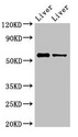 ER81 / ETV1 Antibody - Positive Western Blot detected in Mouse liver tissue, Rat liver tissue. All lanes: ETV1 antibody at 3 µg/ml Secondary Goat polyclonal to rabbit IgG at 1/50000 dilution. Predicted band size: 56, 54, 53, 44, 49, 51 KDa. Observed band size: 56 KDa