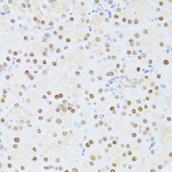 ER81 / ETV1 Antibody - Immunohistochemistry of paraffin-embedded rat pancreas using ETV1 antibody at dilution of 1:100 (40x lens).