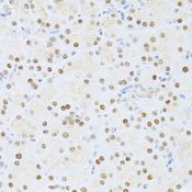 ER81 / ETV1 Antibody - Immunohistochemistry of paraffin-embedded rat pancreas using ETV1 antibody at dilution of 1:100 (40x lens).