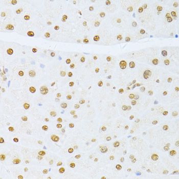 ER81 / ETV1 Antibody - Immunohistochemistry of paraffin-embedded mouse pancreas using ETV1 antibody at dilution of 1:100 (40x lens).