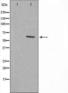 ER81 / ETV1 Antibody - Western blot analysis of extracts of HuvEc cells treated with PMA using ER81 antibody. The lane on the left is treated with the antigen-specific peptide.