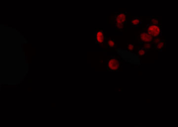 ER81 / ETV1 Antibody - Staining HuvEc cells by IF/ICC. The samples were fixed with PFA and permeabilized in 0.1% Triton X-100, then blocked in 10% serum for 45 min at 25°C. The primary antibody was diluted at 1:200 and incubated with the sample for 1 hour at 37°C. An Alexa Fluor 594 conjugated goat anti-rabbit IgG (H+L) antibody, diluted at 1/600, was used as secondary antibody.