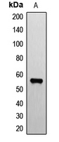 ER81 / ETV1 Antibody - Western blot analysis of ETV1 expression in mouse brain (A) whole cell lysates.