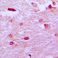 ER81 / ETV1 Antibody - Immunohistochemical analysis of ETV1 staining in human brain formalin fixed paraffin embedded tissue section. The section was pre-treated using heat mediated antigen retrieval with sodium citrate buffer (pH 6.0). The section was then incubated with the antibody at room temperature and detected using an HRP conjugated compact polymer system. DAB was used as the chromogen. The section was then counterstained with hematoxylin and mounted with DPX.