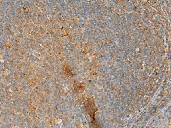 ERAL1 Antibody - Immunohistochemistry of paraffin-embedded Human tonsil tissue  using ERAL1 Polyclonal Antibody at dilution of 1:50(×200)