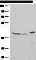 ERAL1 Antibody - Western blot analysis of SKOV3 Hela and HepG2 cell lysates  using ERAL1 Polyclonal Antibody at dilution of 1:500