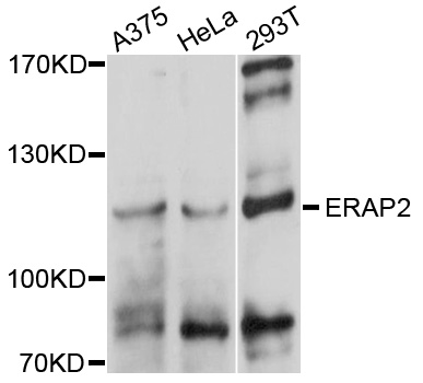 ERAP2 / Aminopeptidase Antibody - Western blot analysis of extracts of various cells.