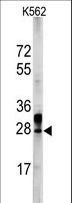 ERAS Antibody - Western blot of ERAS Antibody in K562 cell line lysates (35 ug/lane). ERAS (arrow) was detected using the purified antibody.