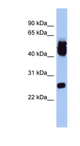 ERAS Antibody - ERAS antibody Western blot of Fetal Lung lysate. This image was taken for the unconjugated form of this product. Other forms have not been tested.