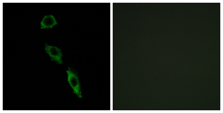 ERAS Antibody - Immunofluorescence analysis of A549 cells, using ERAS Antibody. The picture on the right is blocked with the synthesized peptide.