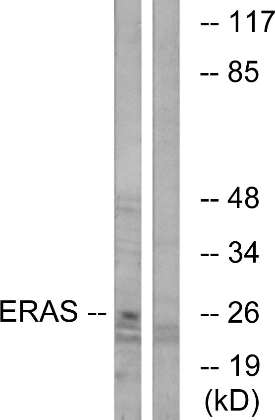 ERAS Antibody - Western blot analysis of lysates from Jurkat cells, using ERAS Antibody. The lane on the right is blocked with the synthesized peptide.