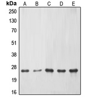 ERAS Antibody - Western blot analysis of ERAS expression in HeLa (A); Jurkat (B); mouse liver (C); PC12 (D); rat kidney (E) whole cell lysates.