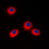 ERAS Antibody - Immunofluorescent analysis of ERAS staining in Jurkat cells. Formalin-fixed cells were permeabilized with 0.1% Triton X-100 in TBS for 5-10 minutes and blocked with 3% BSA-PBS for 30 minutes at room temperature. Cells were probed with the primary antibody in 3% BSA-PBS and incubated overnight at 4 C in a humidified chamber. Cells were washed with PBST and incubated with a DyLight 594-conjugated secondary antibody (red) in PBS at room temperature in the dark. DAPI was used to stain the cell nuclei (blue).