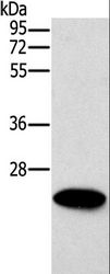 ERAS Antibody - Western blot analysis of Mouse heart tissue, using ERAS Polyclonal Antibody at dilution of 1:500.